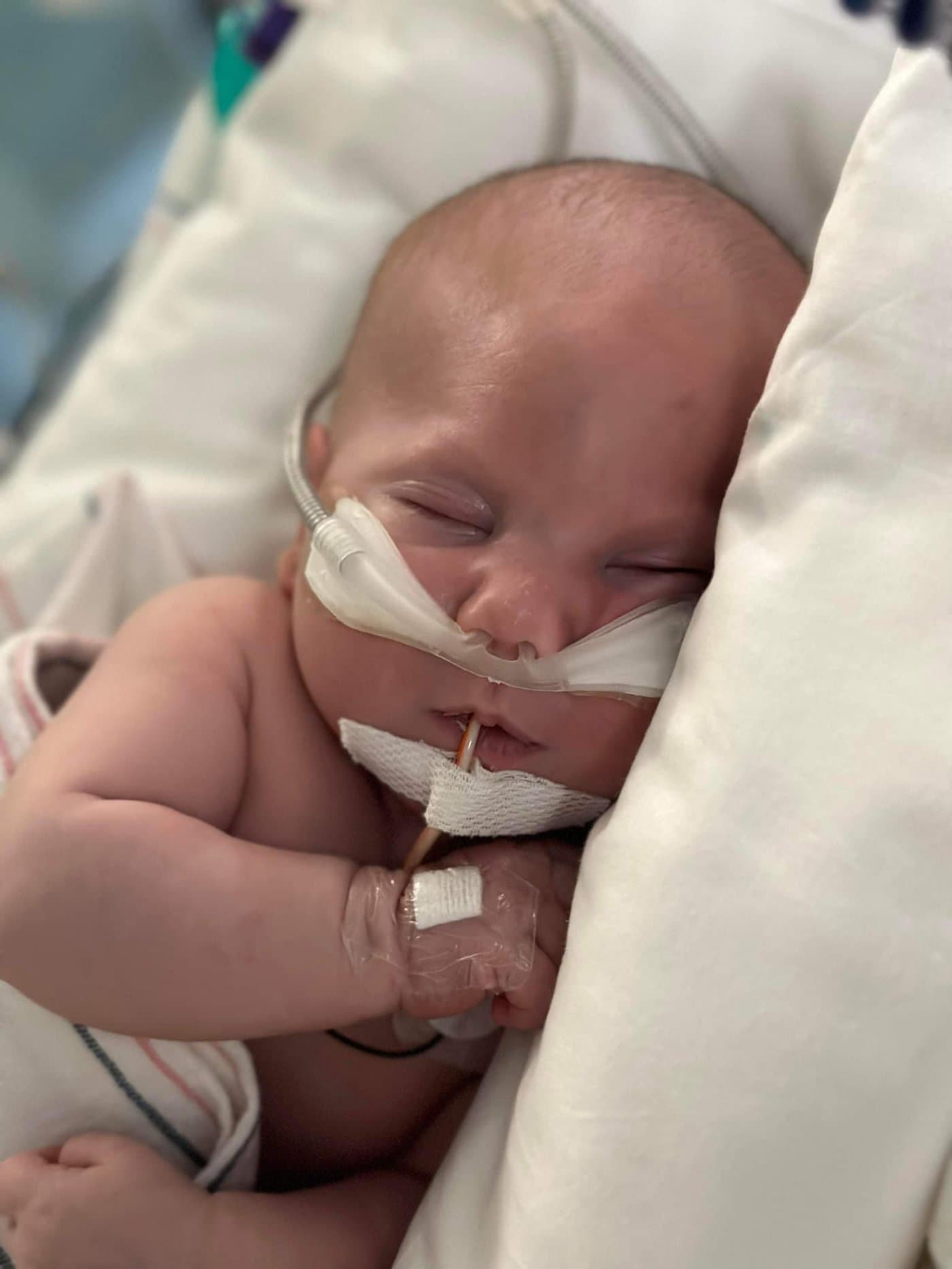 CHAMP beneficiary infant resting in a hospital crib